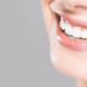 پنج راهکار مراقبت از دندان ها
